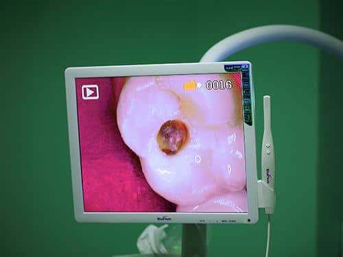 Camera Intraorala Stomatologie