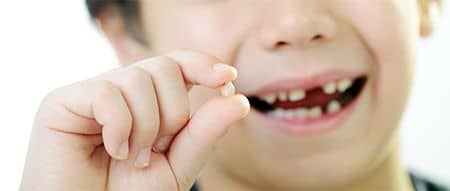 cand cad dintii de lapte