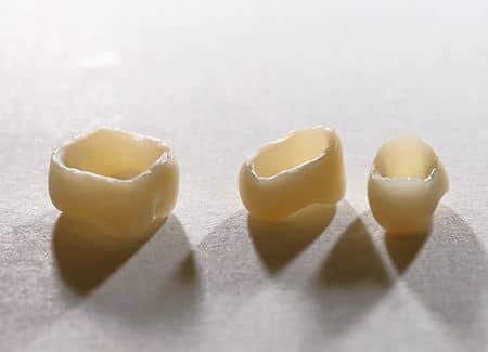 ceramica portelan zirconiu