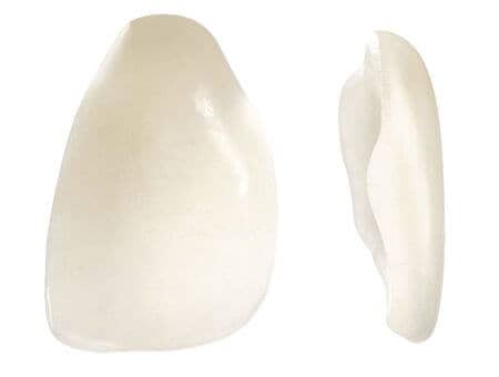 fatete dentare portelan