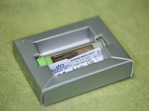 Implant Dentar AB Dental