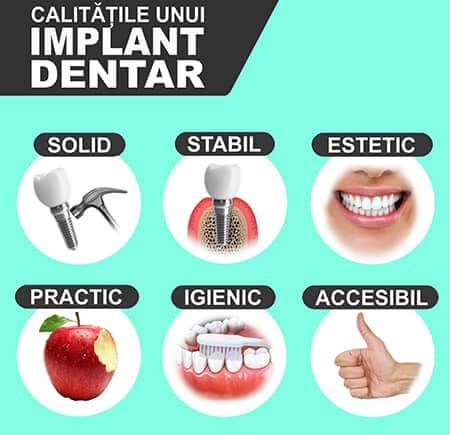 Implant Dentar - Calitati si avantaje