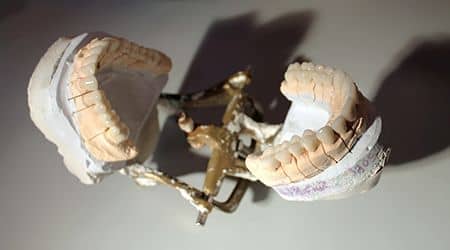 punti dentare totale din zirconiu