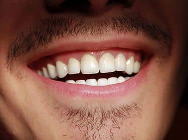 Coroane din zirconiu