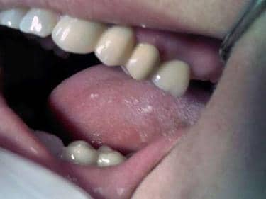 caz clinic stomatologie implant dentar