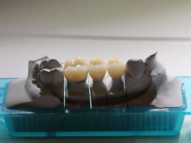 coronite din zirconiu