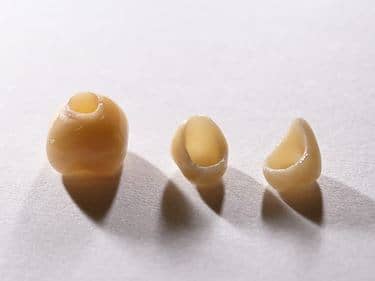 Coroane Dentare din Zirconiu