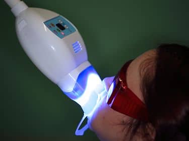 ÎN TIMPUL TRATAMENTULUI - Activarea gelului de albire cu ajutorul lămpii UV tip Zoom / Beyond / Advanced Whitening