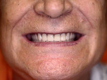 proteze dentare in Sectorul 2