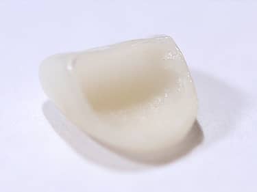 Fațete Dentare ceramice e-Max