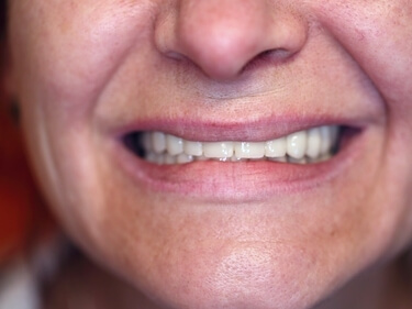 pacient la Cabinet Stomatologic Sos Pantelimon Mega Mall