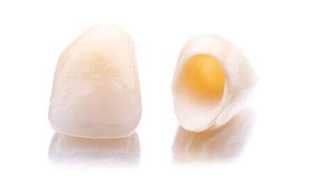 ceramica portelan zirconiu